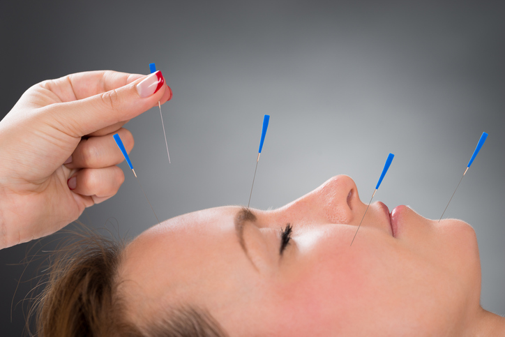 Femeie care-și face acupunctură facială
