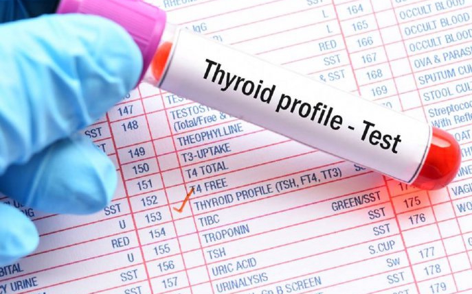 TSH (hormonul de stimulare tiroidiană): valori normale şi motive de îngrijorare