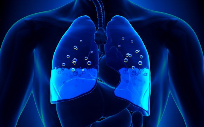 Edemul pulmonar - simptome, diagnostic si tratament