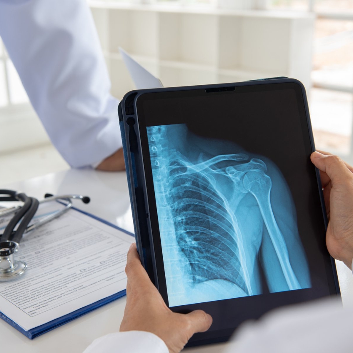 Cât costă un test de osteoporoză în 2024 și de ce ar trebui să îl faci